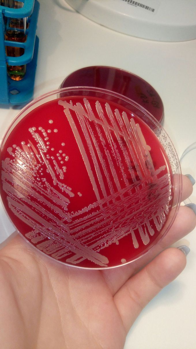 Staphylococcus Aureus
