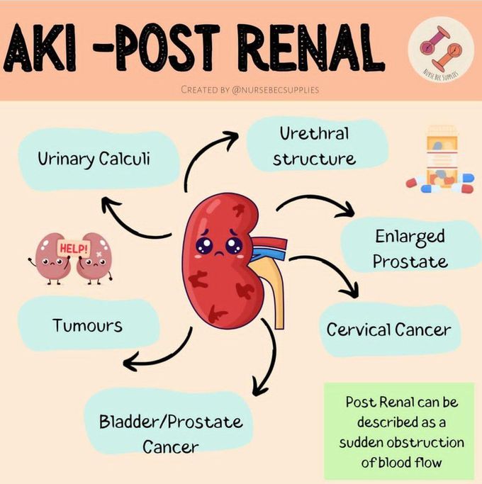 AKI- POST RENAL