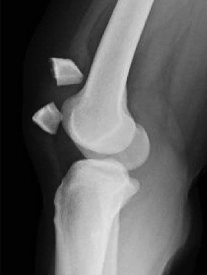What is the diagnosis?