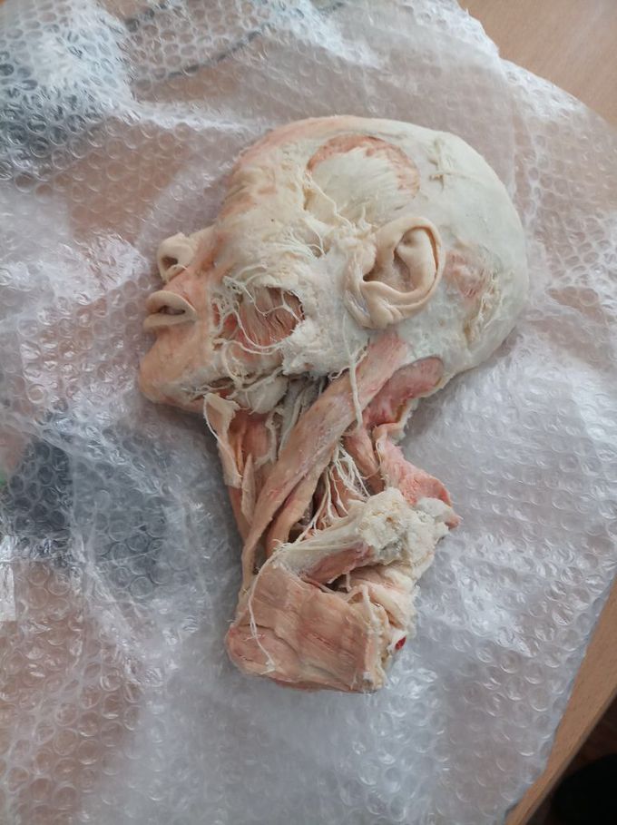 Head and neck muscles