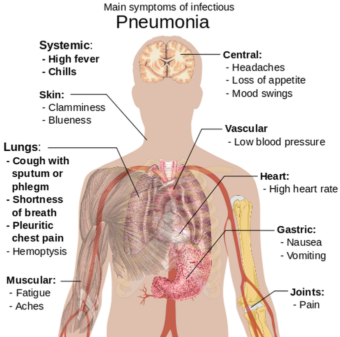 Main symptoms of Pneumonia