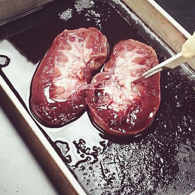 Let's slice up some kidneys! 