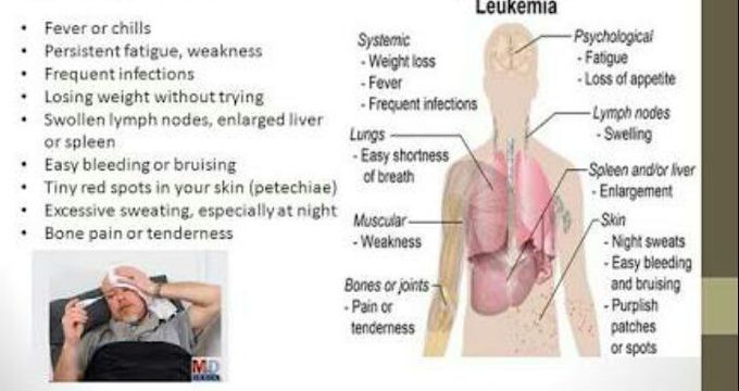 Symptoms of leukemia