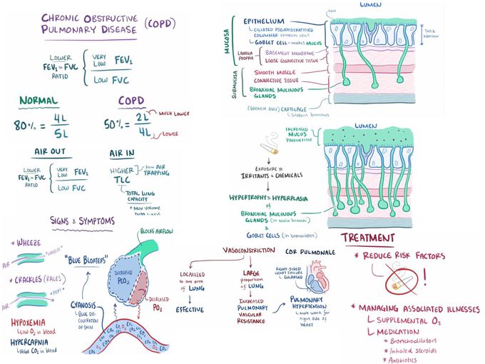 Chronic Bronchitis