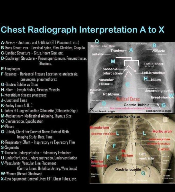 Chest radiography