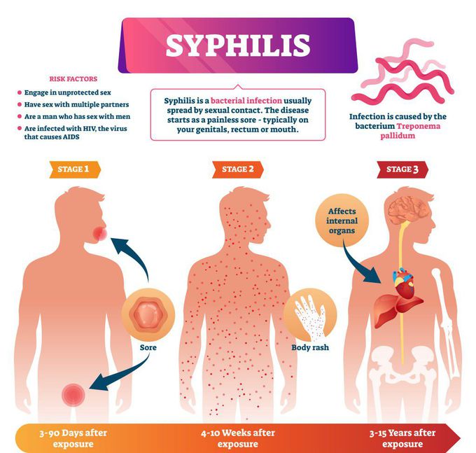 Cause of Syphilis