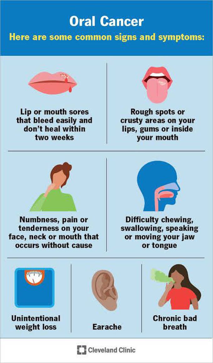 Symptoms of mouth cancer