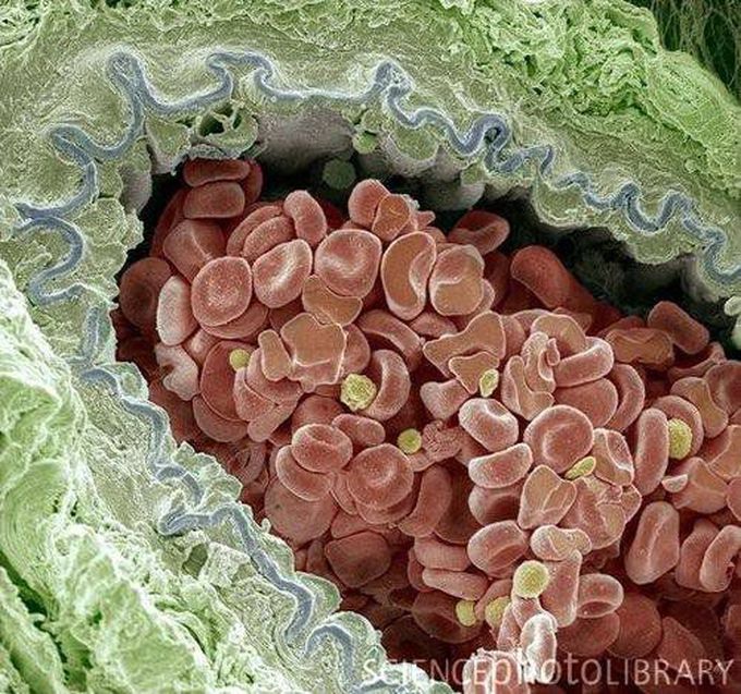 Elastic artery cross-section, coloured scanning electron micrograph (SEM)