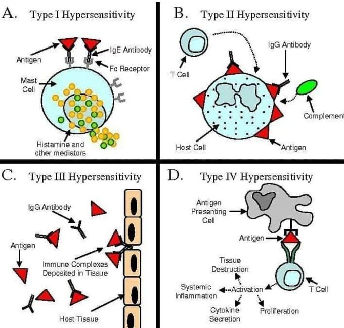 Hypersensitivity