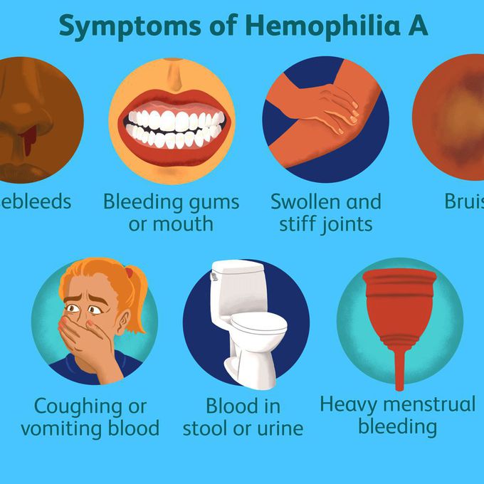 Hemophilia A