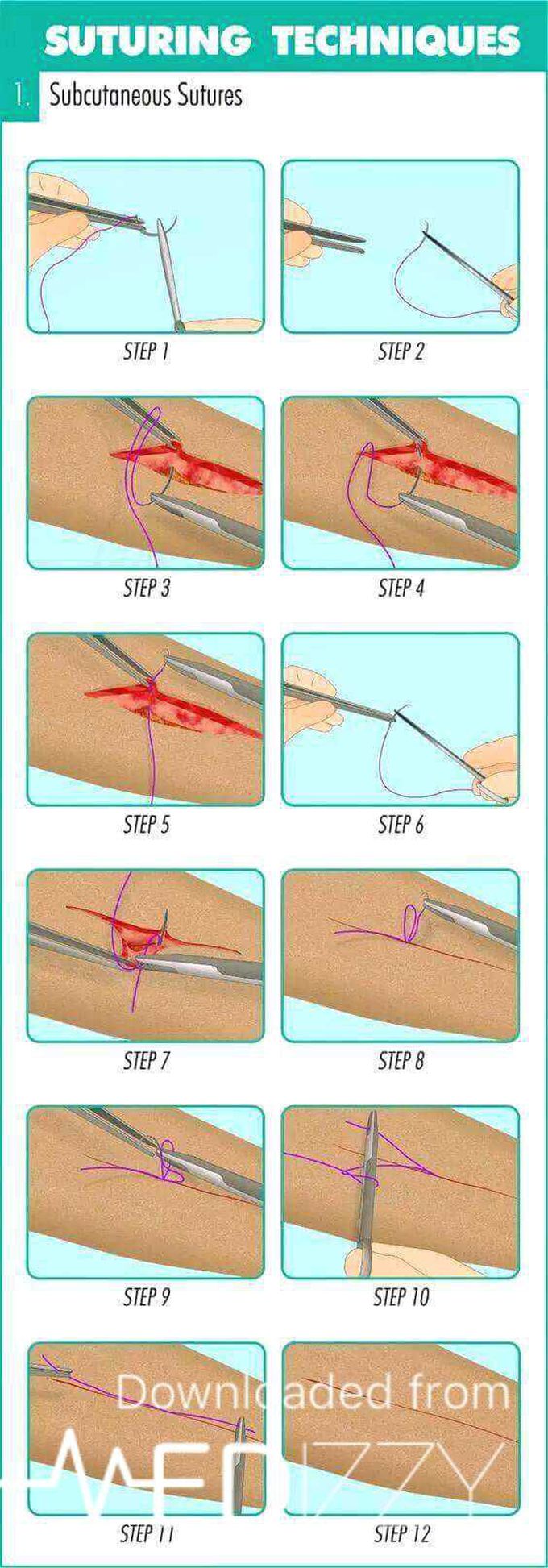 Surgery tip