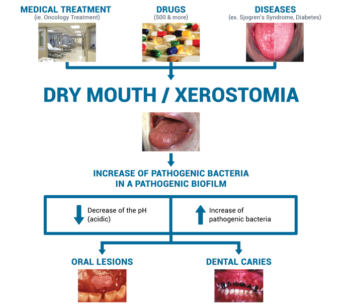 Treatment for Xerostomia