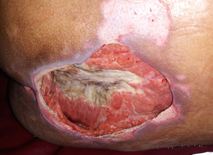 What is your diagnosis?