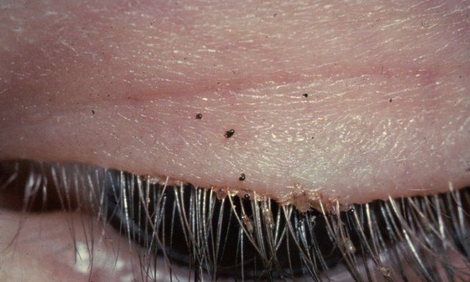 What is your diagnosis?