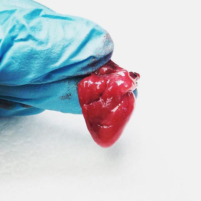 Tiny fetus heart