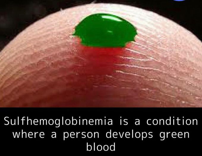 Do you know some people have green blood ..