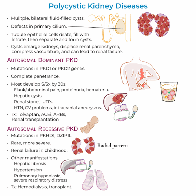 Polycystic Kidney Disease