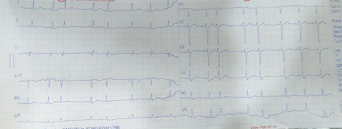 What is your diagnosis?