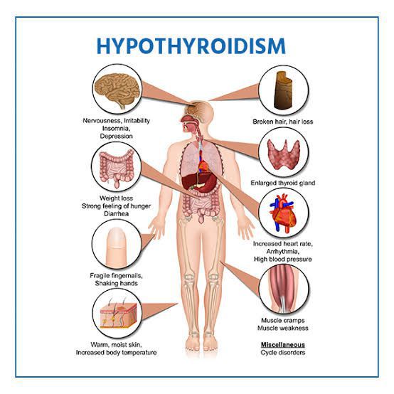 symptoms-of-hypothyroidism-medizzy