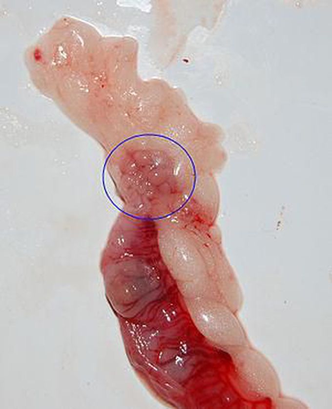 Polycystic Ovary Syndrome - The Problem And Its Solution 