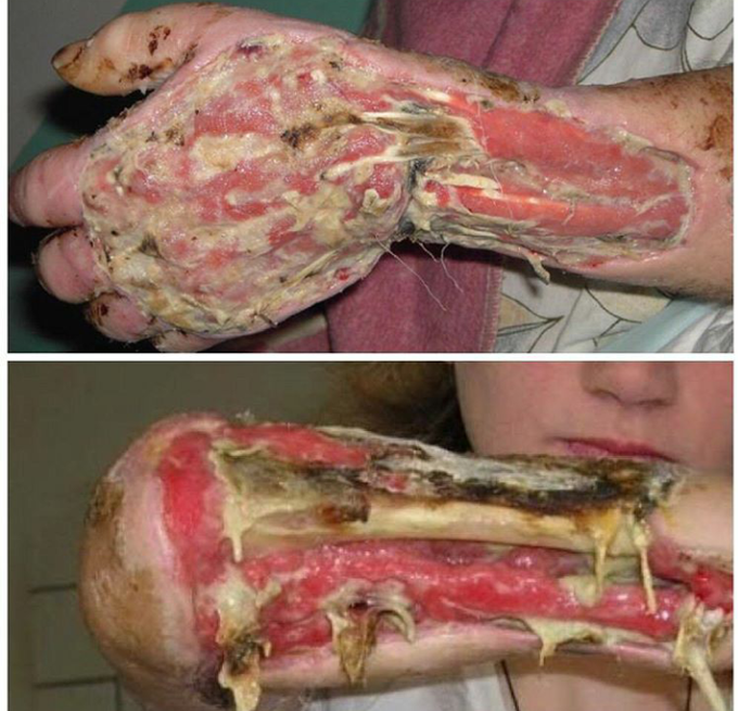 krokodil droga