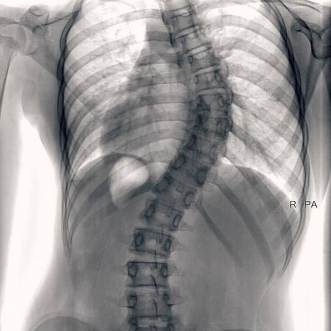 What is your diagnosis?
