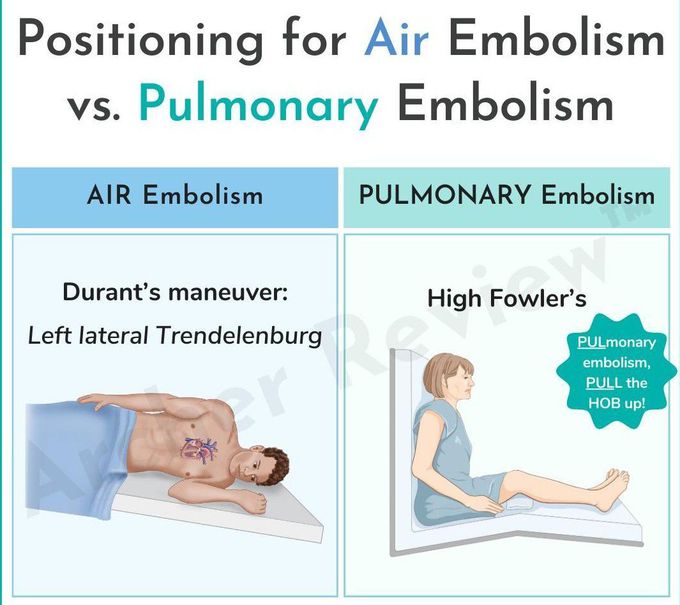 Positioning for Embolism