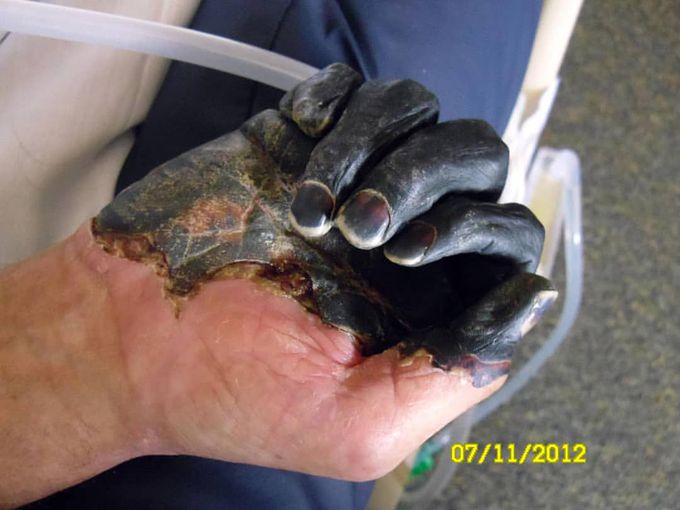 The Black Death