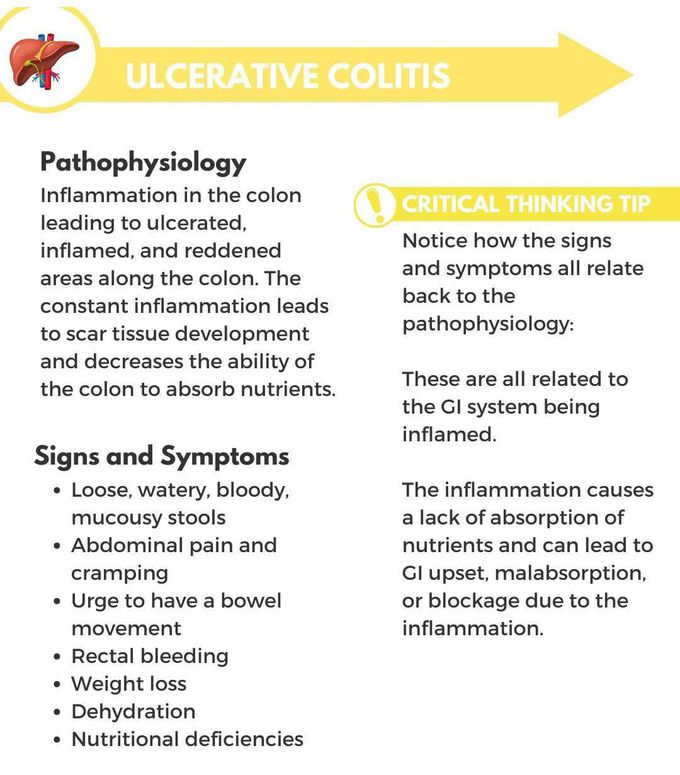 Ulcerative Colitis