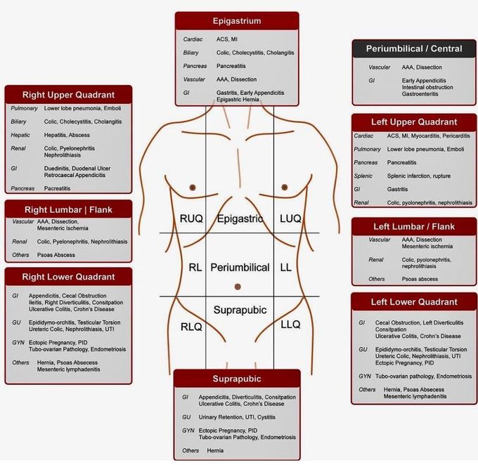 DD of Abdominal Pain