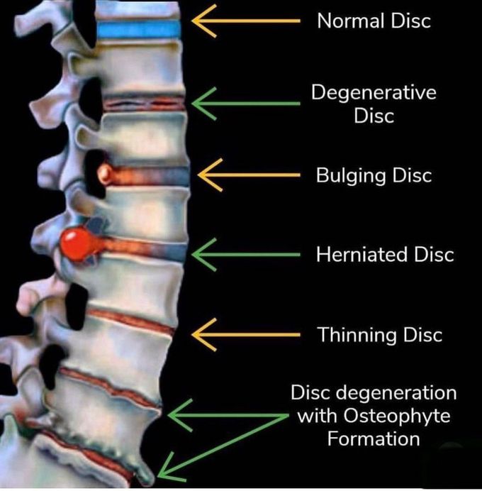 The Disc