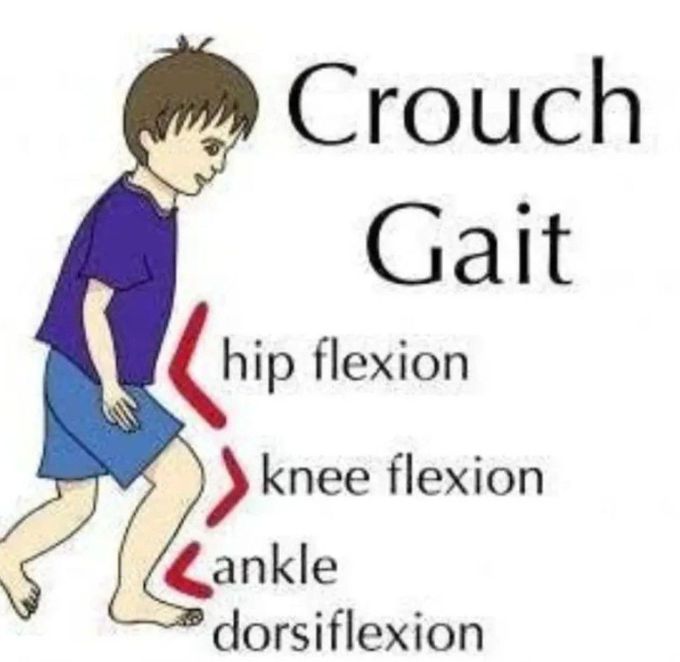Crouch Gait