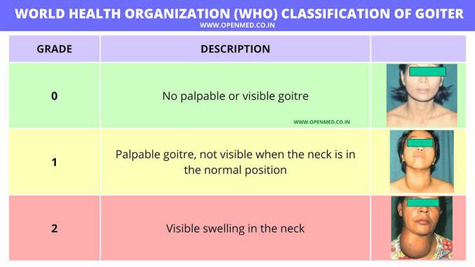 WHO classification of Goiter