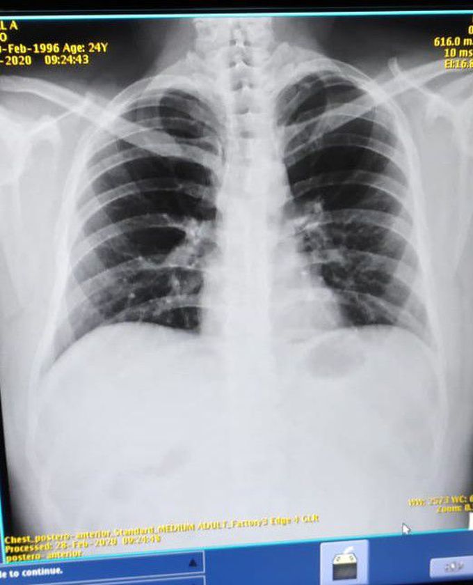 Diagnosis?
