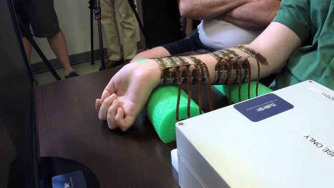 Paralyzed man moves his hand controlled by his own brain for the first time.