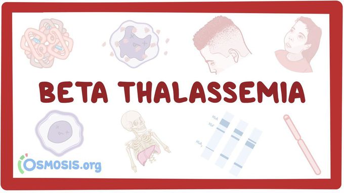 Beta Thalassemia - causes, symptoms, diagnosis, treatment, pathology