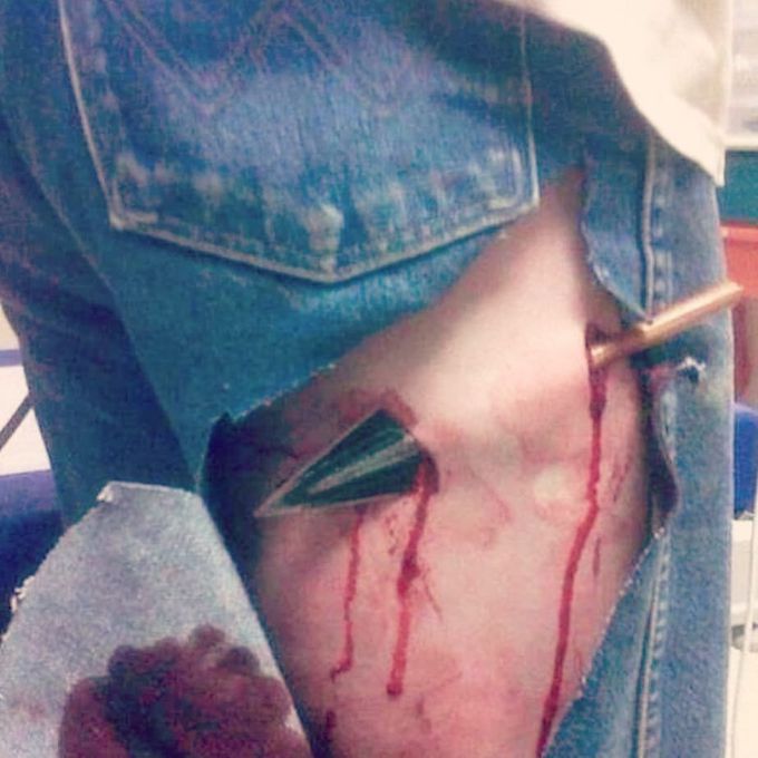 Arrow accident 