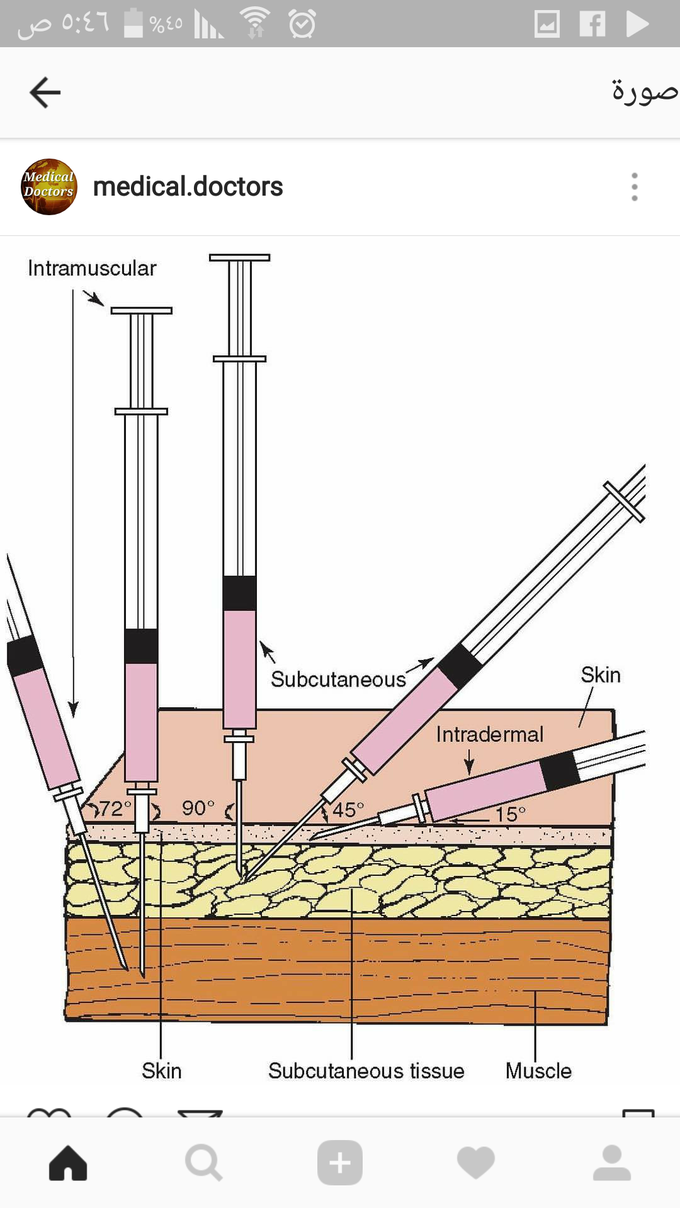 injection