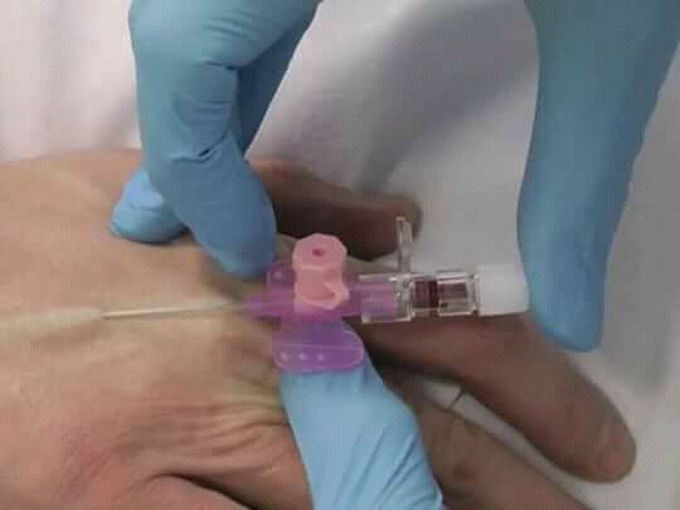 WHAT PROCEDURE IS THIS??????