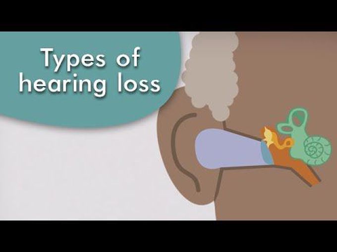 Hearing loss Types