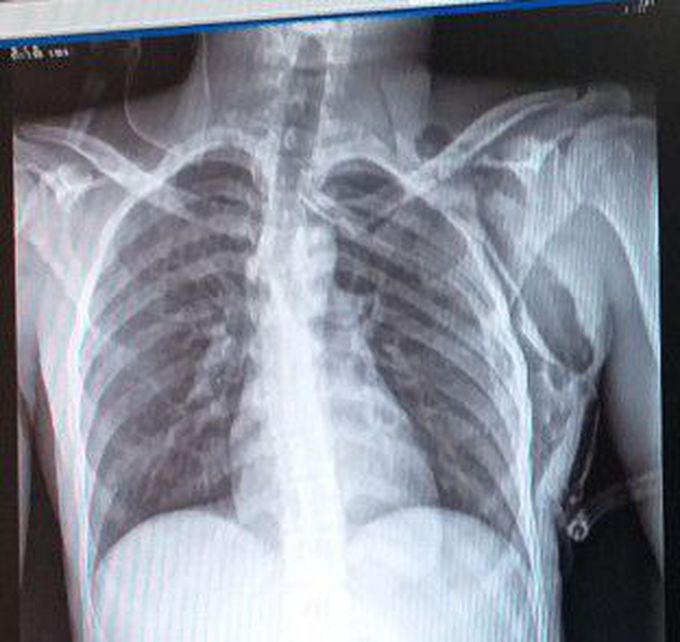 What is your diagnosis?