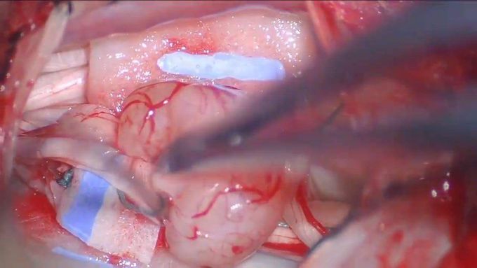 Medical Videos