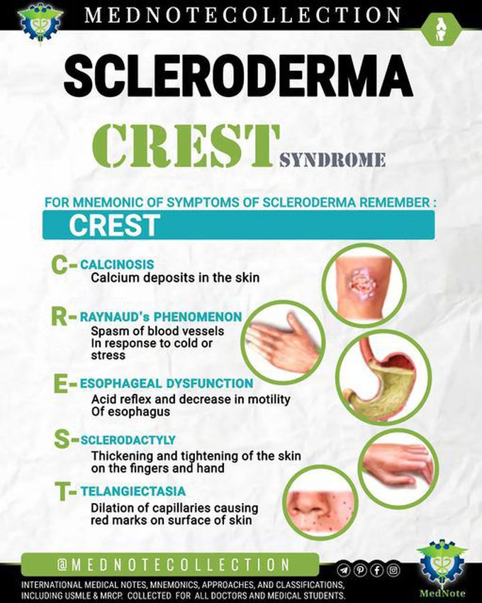 🧠 SCLERODERMA