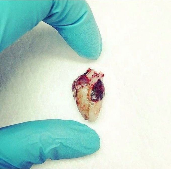 Heart of a fetus