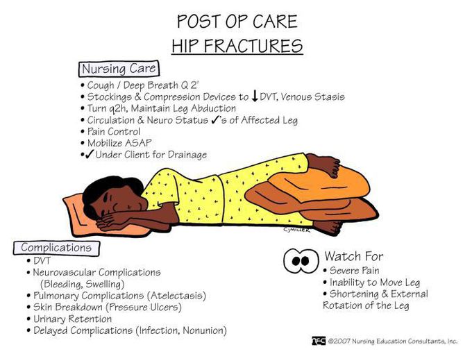 Post op care hip fracture