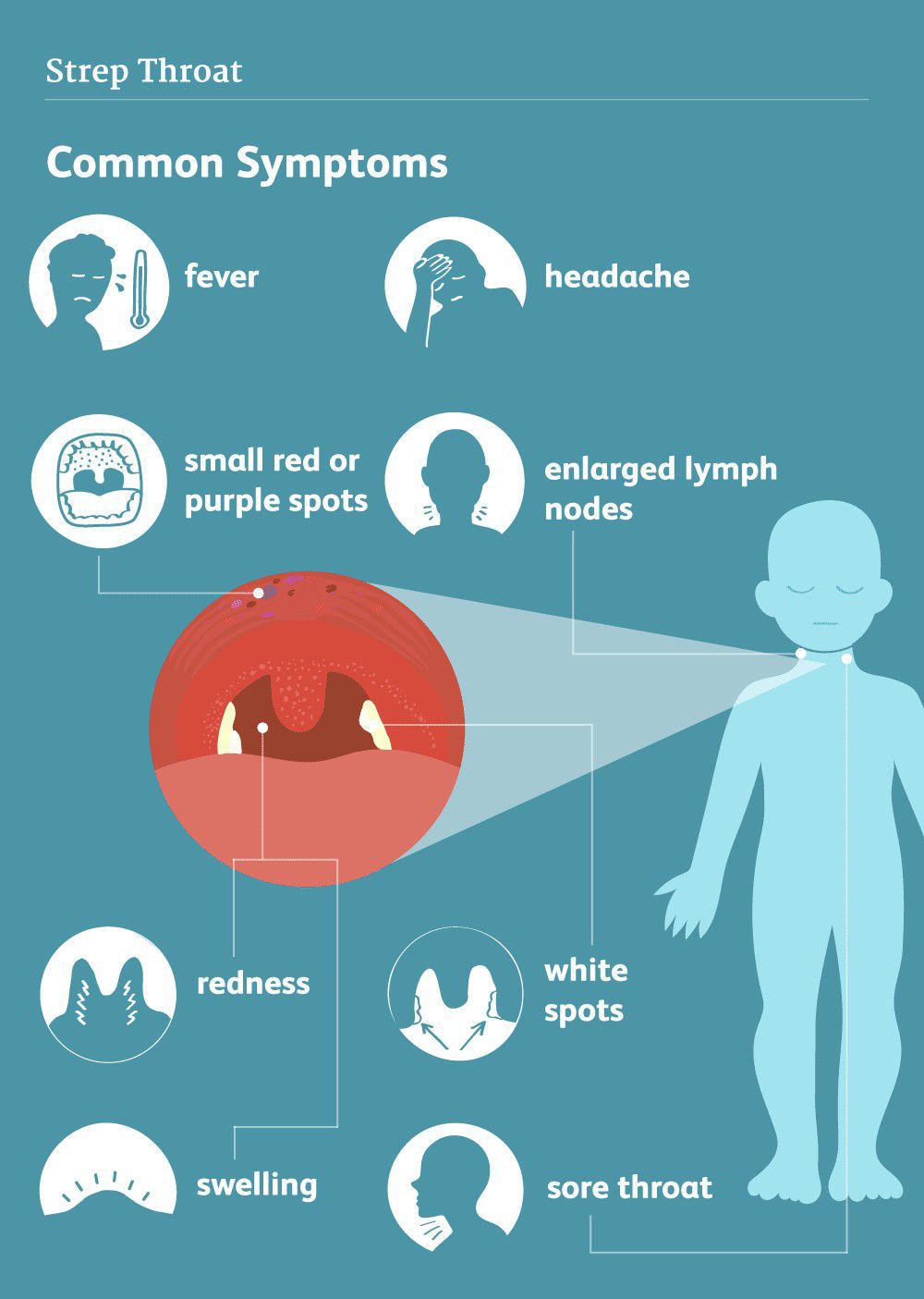 symptoms-of-strep-throat-medizzy