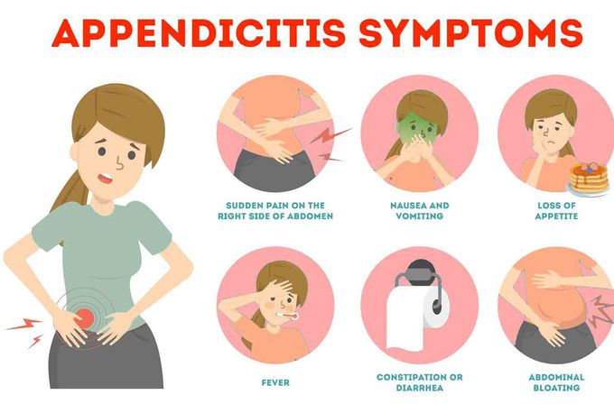 Symptoms of appendicitis