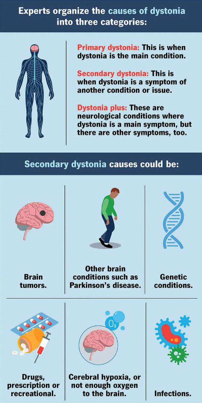 Causes of Dystonia