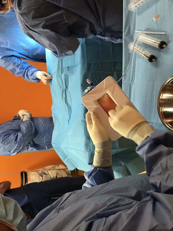 Lipocell treatment for knee damage