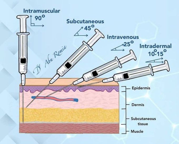Types of injections